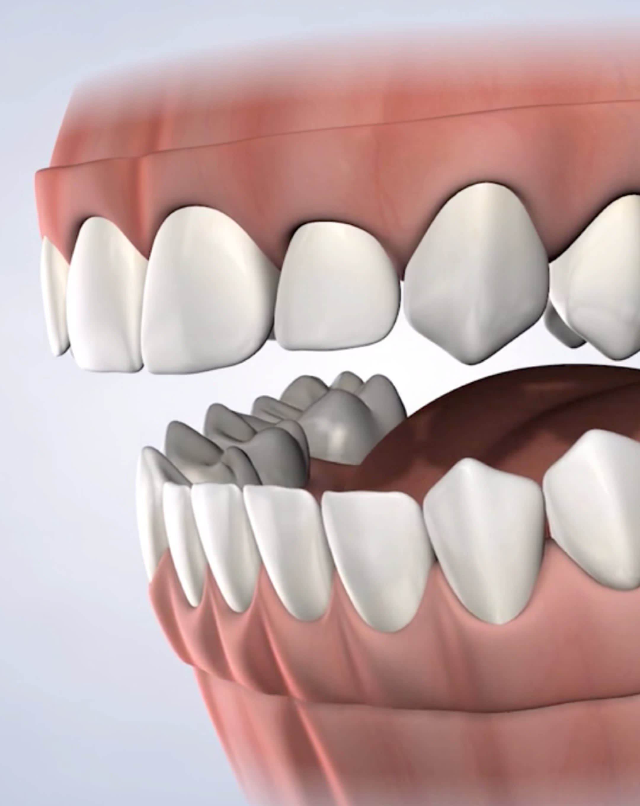 Pre prosthetic surgery procedure mobile