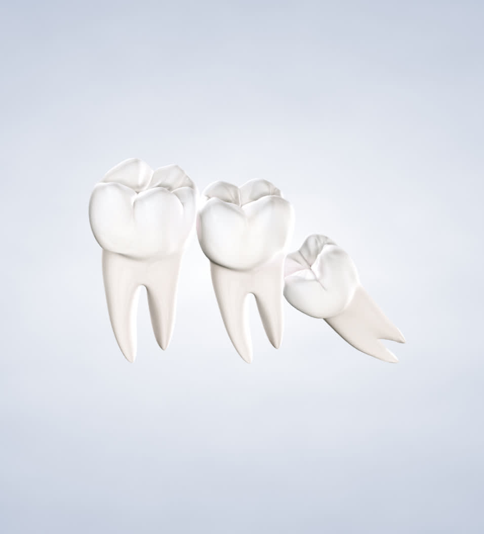 Wisdom teeth procedure query page