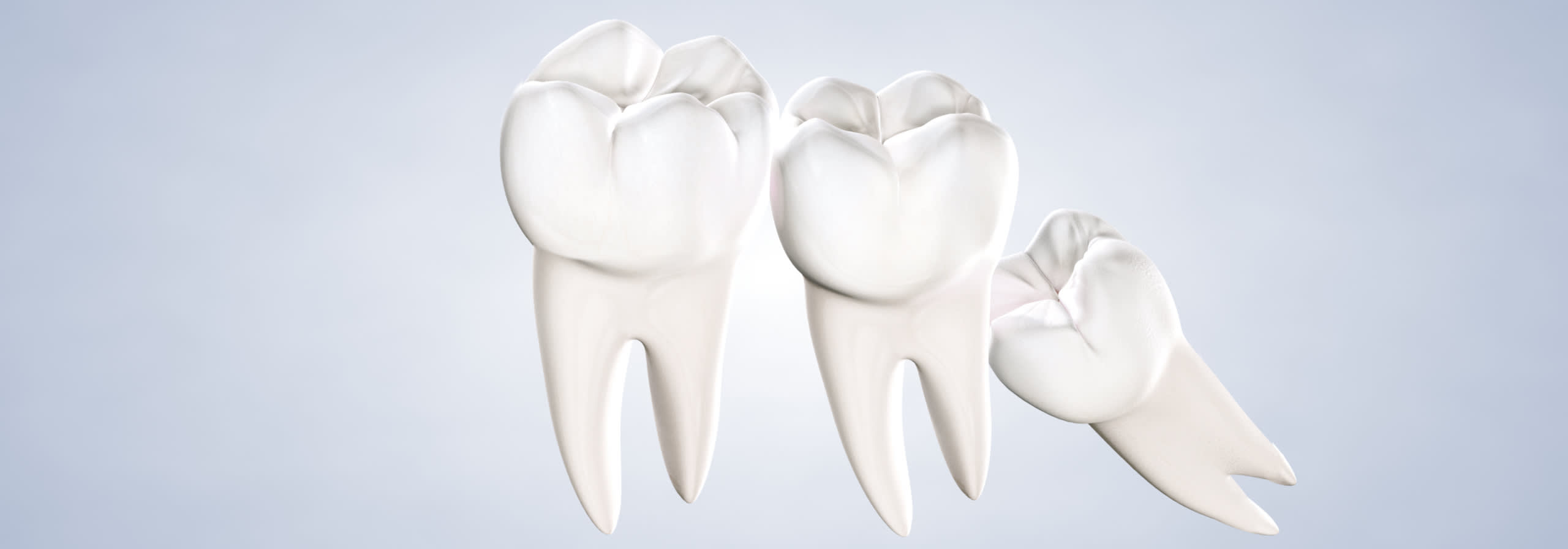 Wisdom teeth removal in Aliso Viejo, CA.